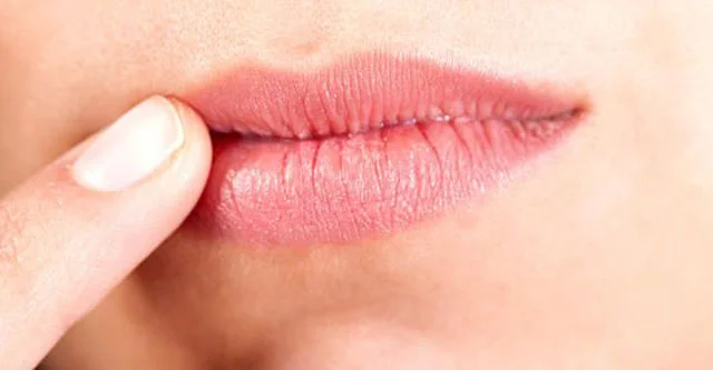 How does Diabetes cause Dry lips